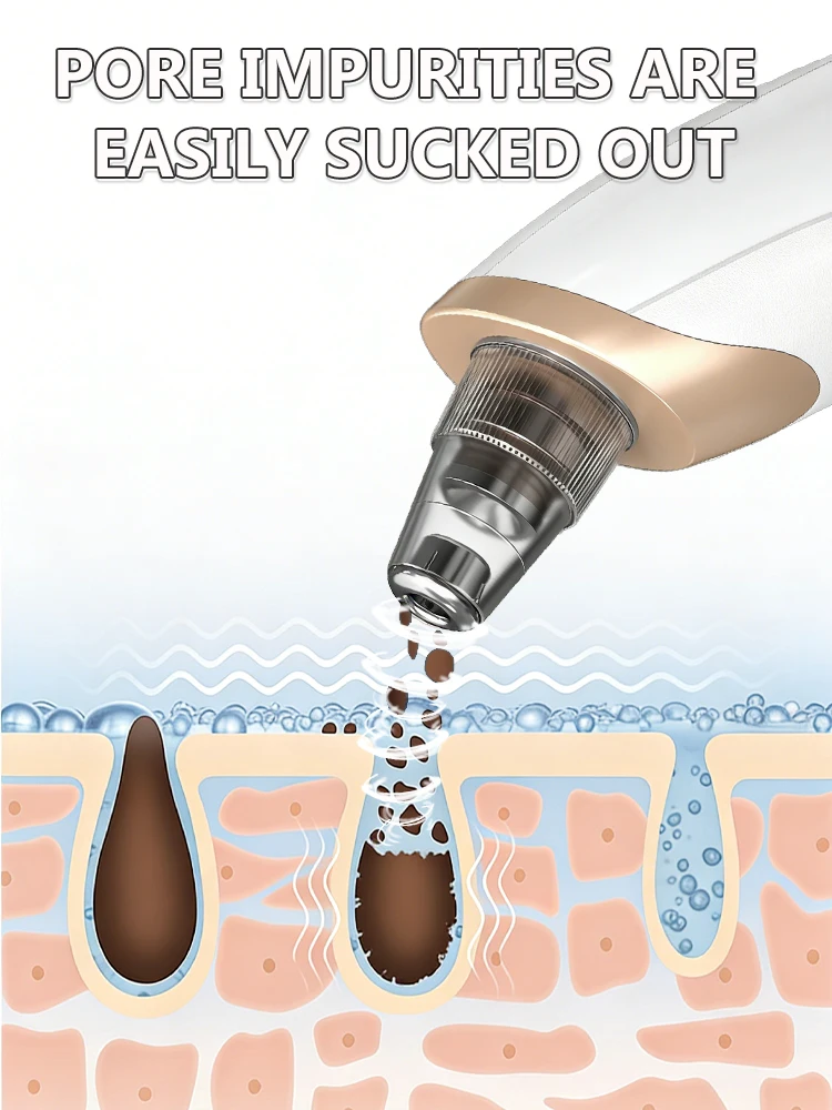 Generation-2, Removes impurities from the surface of the nose with high tech vacuum suction, say goodbye to blackheads and acne. 4