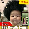 7 days Herbal Hair Growth Hair Oil Repair Scalp Hair Root Follicles Rapid Anti-Loss for Men Women Prevent Baldness Beard Growth
