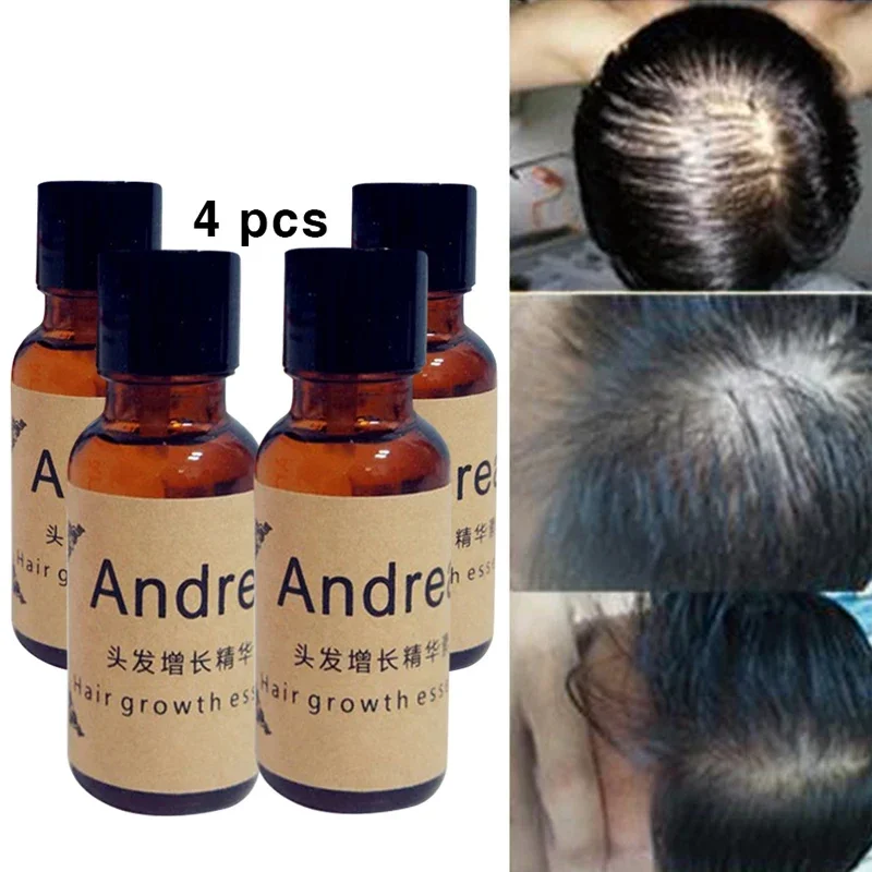 4pcs High Quality Andrea Hair Growth Essence Hair Loss Liquid 20ml Dense Fast Sunburst Hair Growth Restoration Pilatory 100ml east moon dense hair spray anti hair loss solid hairs moisturizing strong thick hair scalp massage repair hair root