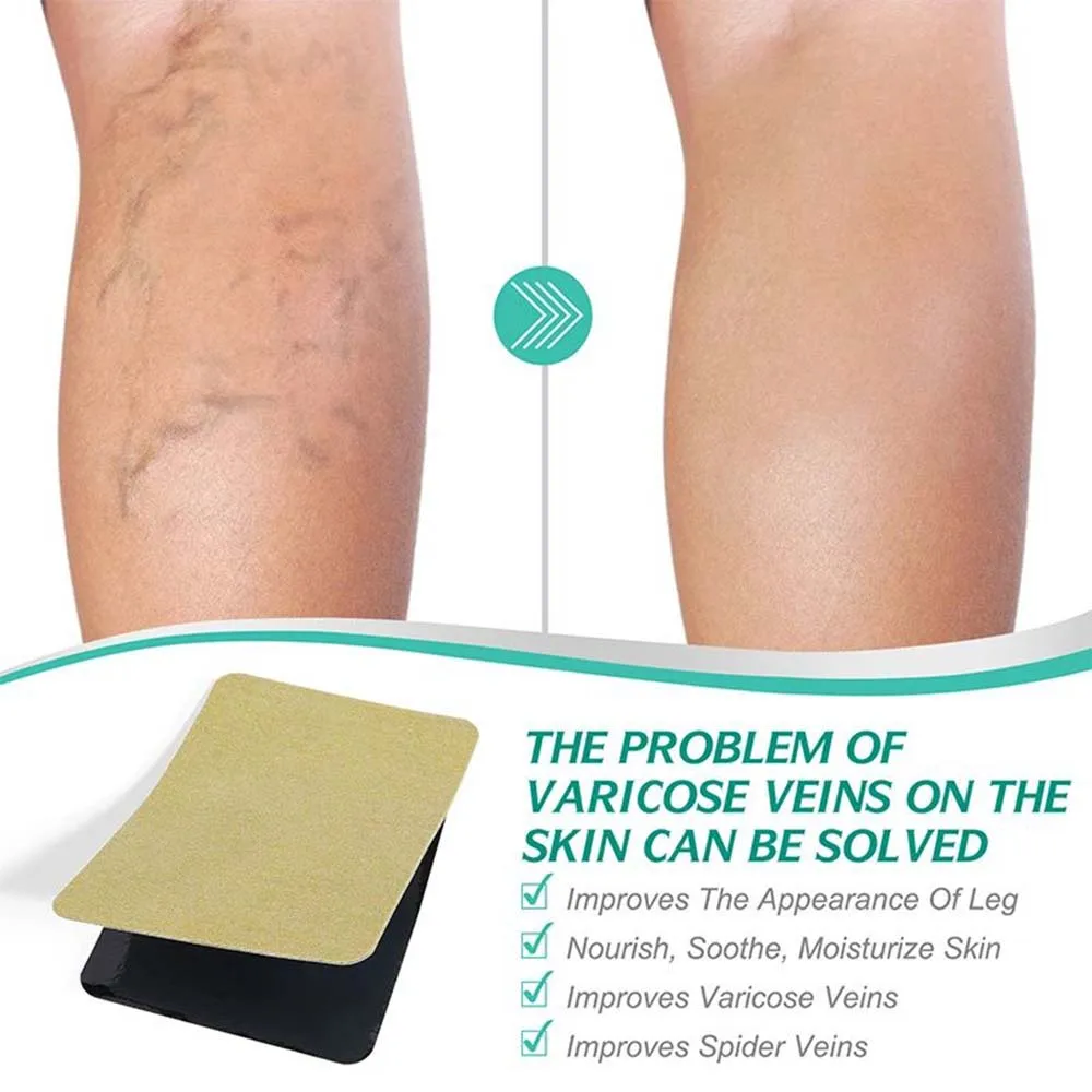 Z20 10PCS Varicose Veins Patch Treatment For Varicose Veins Vasculitis Phlebitis Spider Leg Medical Patch Angiitis Removal
