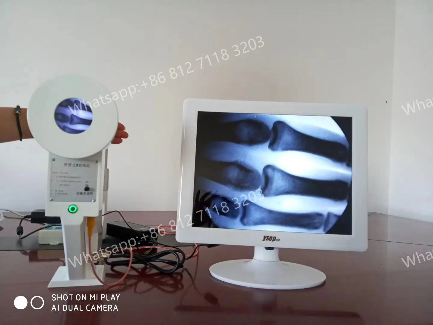 

Cheapest price Medical Handheld Portable X-ray Machine Medical Digital Mini C Arm X Ray Fluoroscopy Machine For Hospital