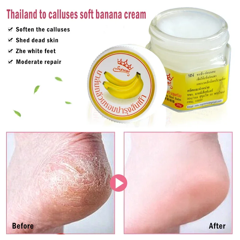 Anti-Drying Crack Foot Cream Heel Cracked Repair Cream Banana Oli Moisturizing Removal Dead Skin Hand Feet Smooth Care 각질제거 pain analgesic cream