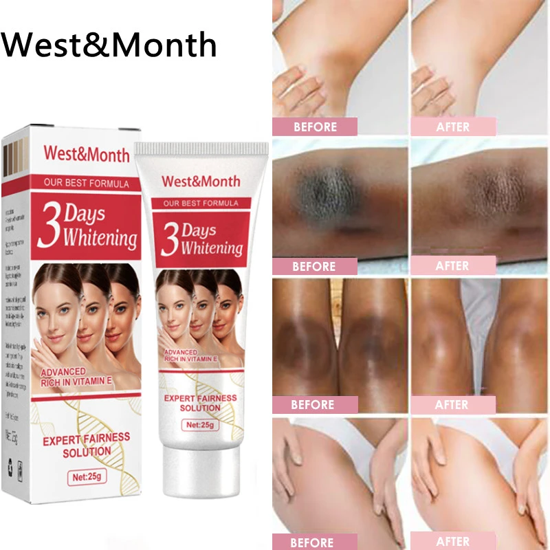 3Days Kojic Acid Armpit Whitening Cream Skin Lightening Bleaching Cream For  Dark Skin Legs Knees Whitening Intimate Body Lotion