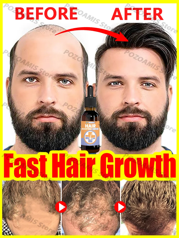 Produits croissance des cheveux dites adieu calvitie perte de cheveux 99% avis positifs