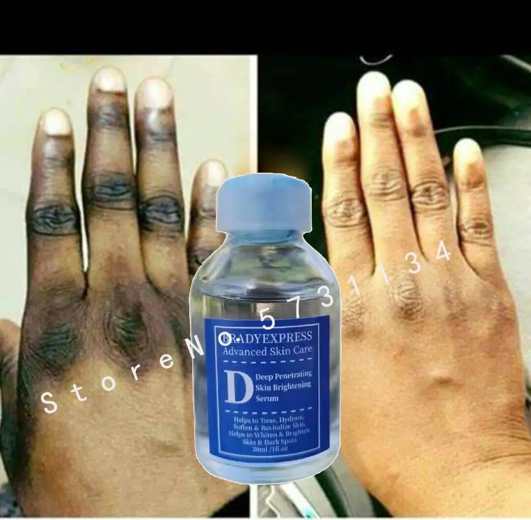 

Strong Whitening Serum For Removing Dark Knuckle Finger Elbow and Knee