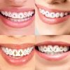 Hot Sale Dental Teeth Gem Decoration Tooth Gem Kit With Curing Light And Glue Solid Crystal Tooth Gems 6