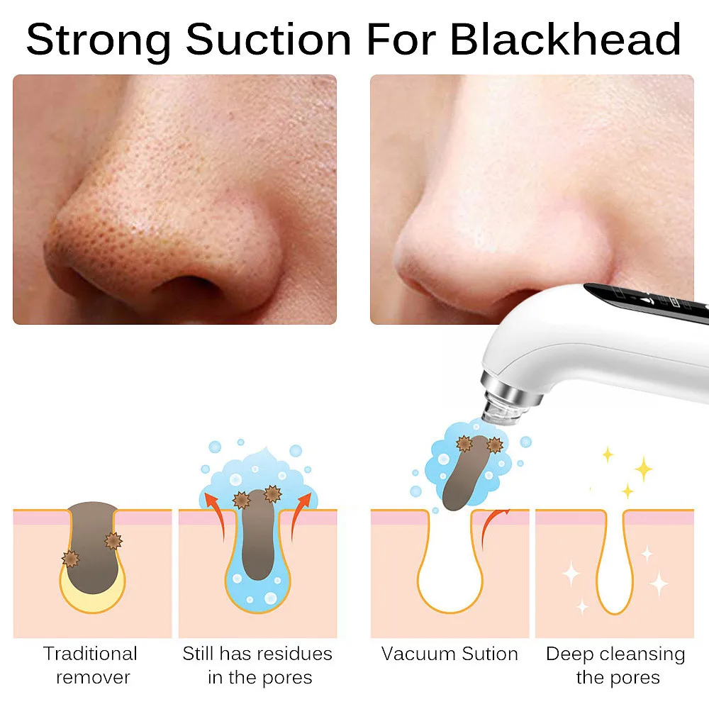 Blackhead Removal Pore Vacuum Face Cleaner Electric Pimple Black Head Remover USB Rechargeable Water Cycle Facial Cleaning Tools 5