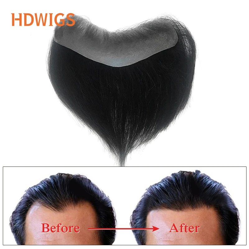 Straight Man Toupee V Style Front Wigs For Men 100% Human Remy Hair Thin  Skin Full Pu Men's Capillary Prosthesis Natural Color - Toupee - AliExpress