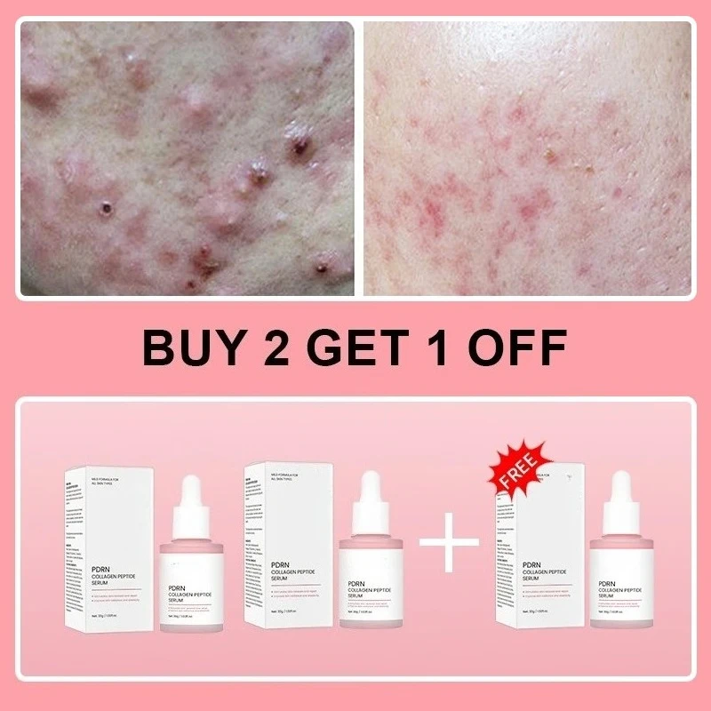 buy 2 free 1