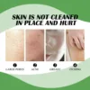 Facial Cleansing Soap Anti Acne Remove Pimples Blackhead Dark Spots Shrink Pores Gentle Moisturizing Soothing Face Wash Cleanser 5
