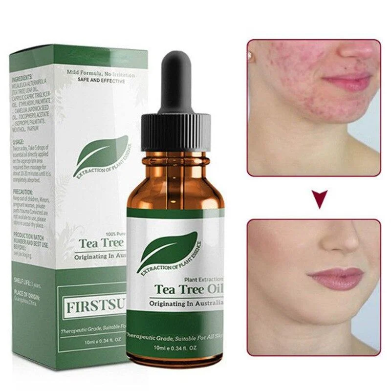 Tea Tree Oil Anti Acne Repair Serum Effective Acnes Removes Fade