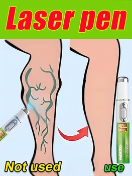 Blue Light Therapy Pen 1