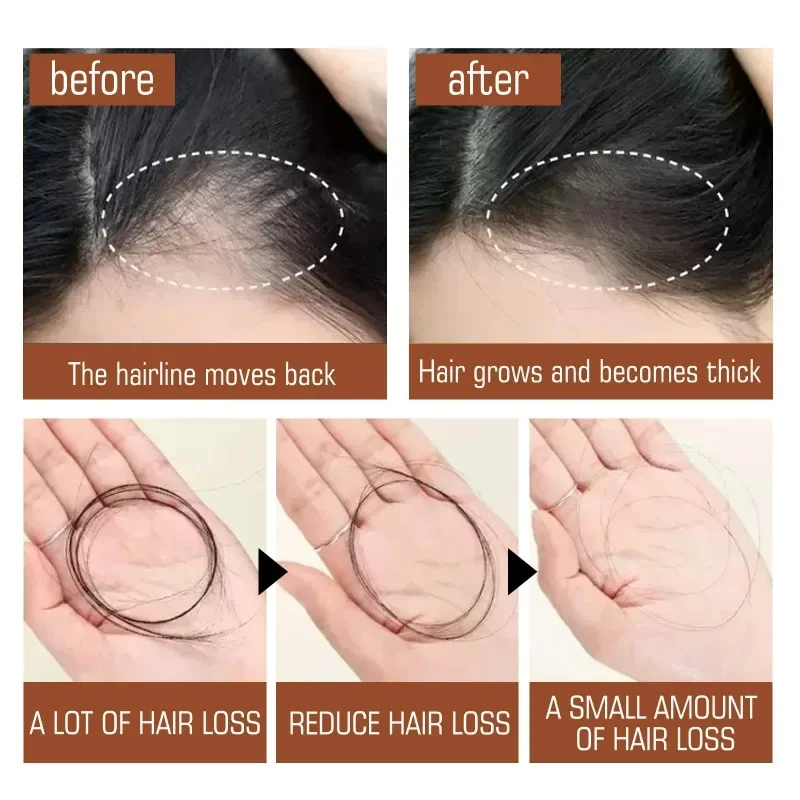 Natural 100% Pure Batana Oil Butter Hair Mask Anti Break Loss Hair Growth From Honduras Loss Treatment for Black Men Women hair mask
