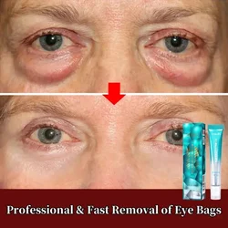 Magic Wrinkle Removal Eye Cream 7 Days Fade Fine Lines Anti Dark Circles Serum Remove Eye Bag Puffiness Anti-Aging Firm Eye Care