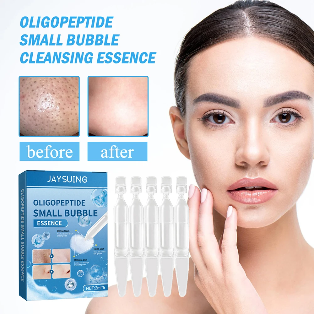 Oligopeptide Small Bubble Cleansing Essence Delicate Repair Clean Blackheads Acne Moisturizing Super Clean Shrink Pores 1pc upgraded paint roller cleaner super easy clean tools paint roller spinner brush cleaner for use house painting supplies