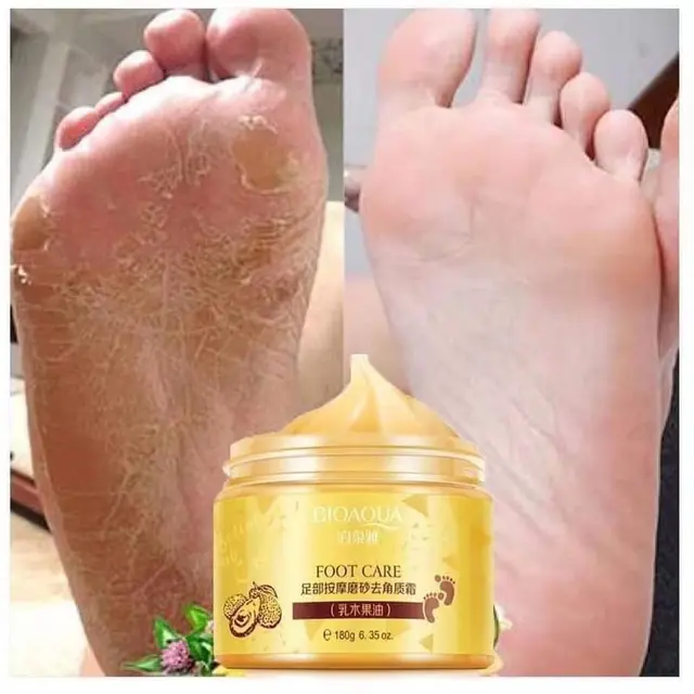 Treat Your Feet to the Ultimate Pampering with YMEYFAN s Shea Butter Exfoliating Foot Cream