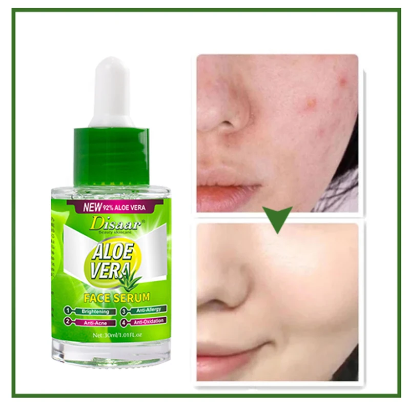 

Face Serum Natural Aloe Vera Moisture Replenishment Shrink Pore Brighten Skin Care Firming Nourish Skin Whitening Freckle 30ml
