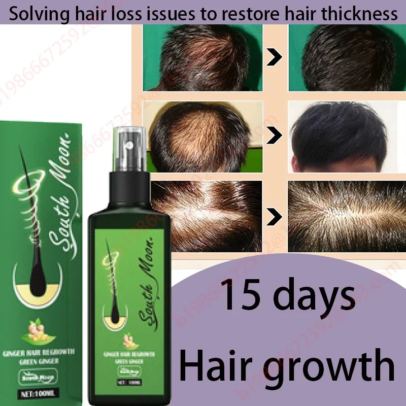 

Fast hair growth promoter products Hair loss Hereditary Seborrheic alopecia treatment oil For Hair growth essence Natural safety