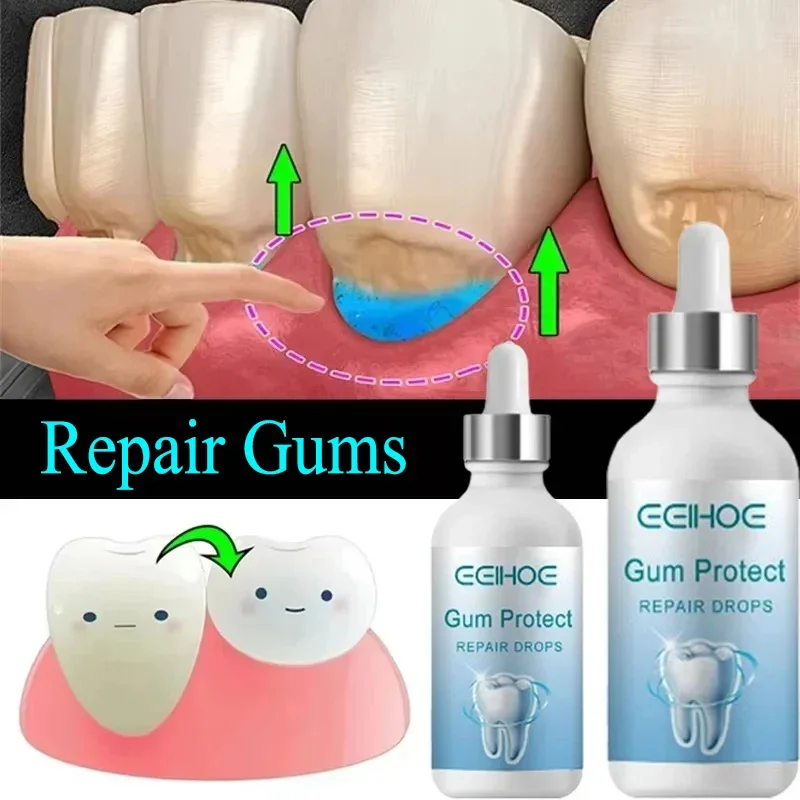 Rapid Repair Gums Serum Effectively Relieve Tooth Allergy Dental Caries Tooth Cleaning Toothpaste Relieve Damage Drops