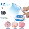 Physical Therapy Equipment Uvb 311nm Lamps Uv Light Phototherapy Therapy For Psoriasis Disease VItiligo Treatment Lamp 1