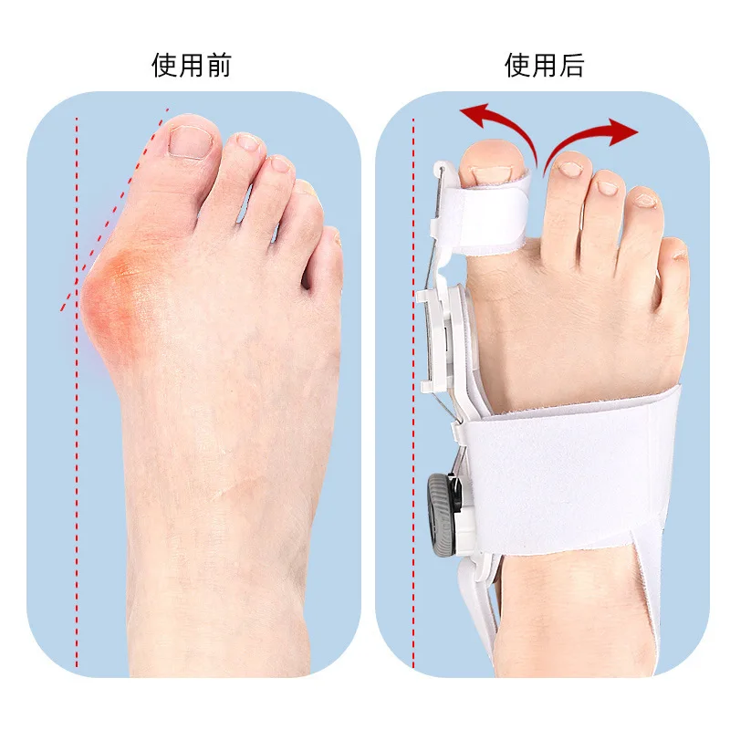 Toe Separators Toe Corrector Bunion Corrector Unisex Foot Hallux Valgus Braces Rotatable Toe Separator Straightener Adjustable Pedicure Finger Toe Corrector