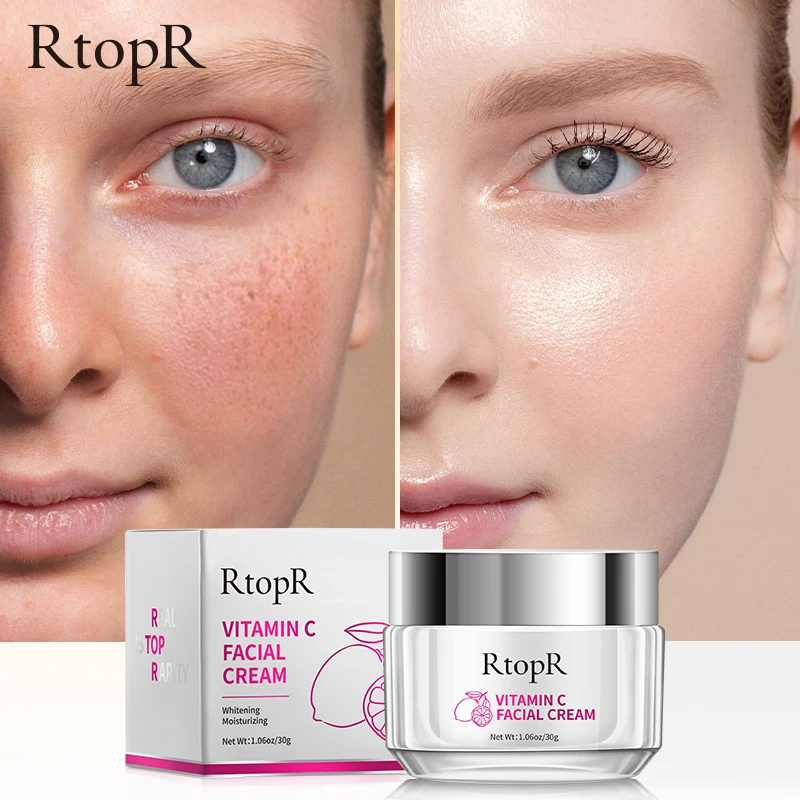 RtopR Whitening VITAMIN C Face Cream Moisturizing Cream Lighten Facial Melanin Care Product For Women Improve Facial Dull Skin