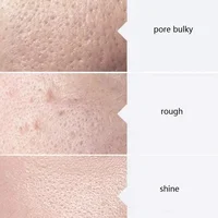 Sérum de Soins du Visage AS1 SA2 AO3, Solution Aqua Peel pour Machine Faciale, Livres Profonds, Kit de 3 Sérums, 400ml 5