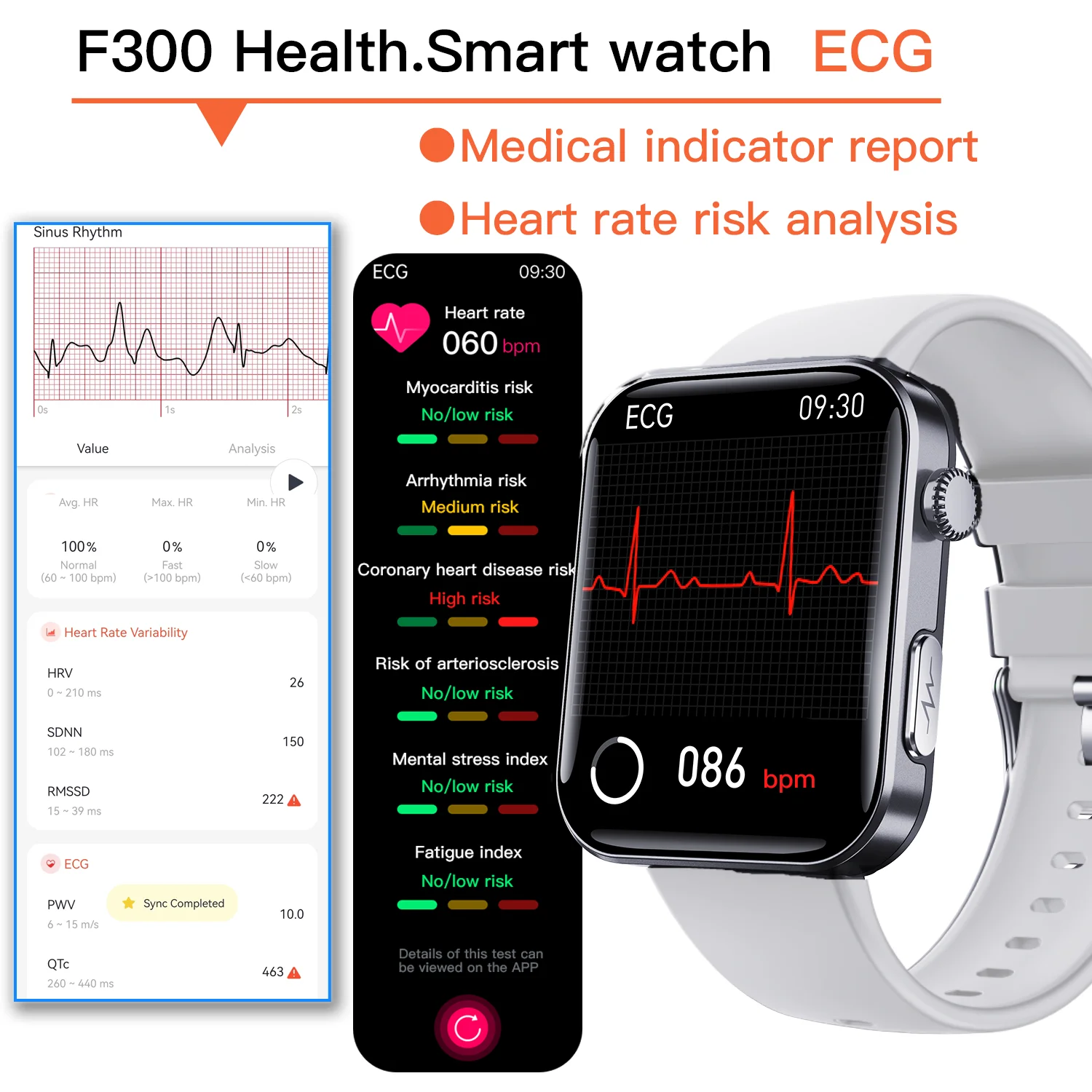 Smart blood sugar watch 24h measurement of glucose blood pressure lipids uric acid ECG wireless Bluetooth APP Health care