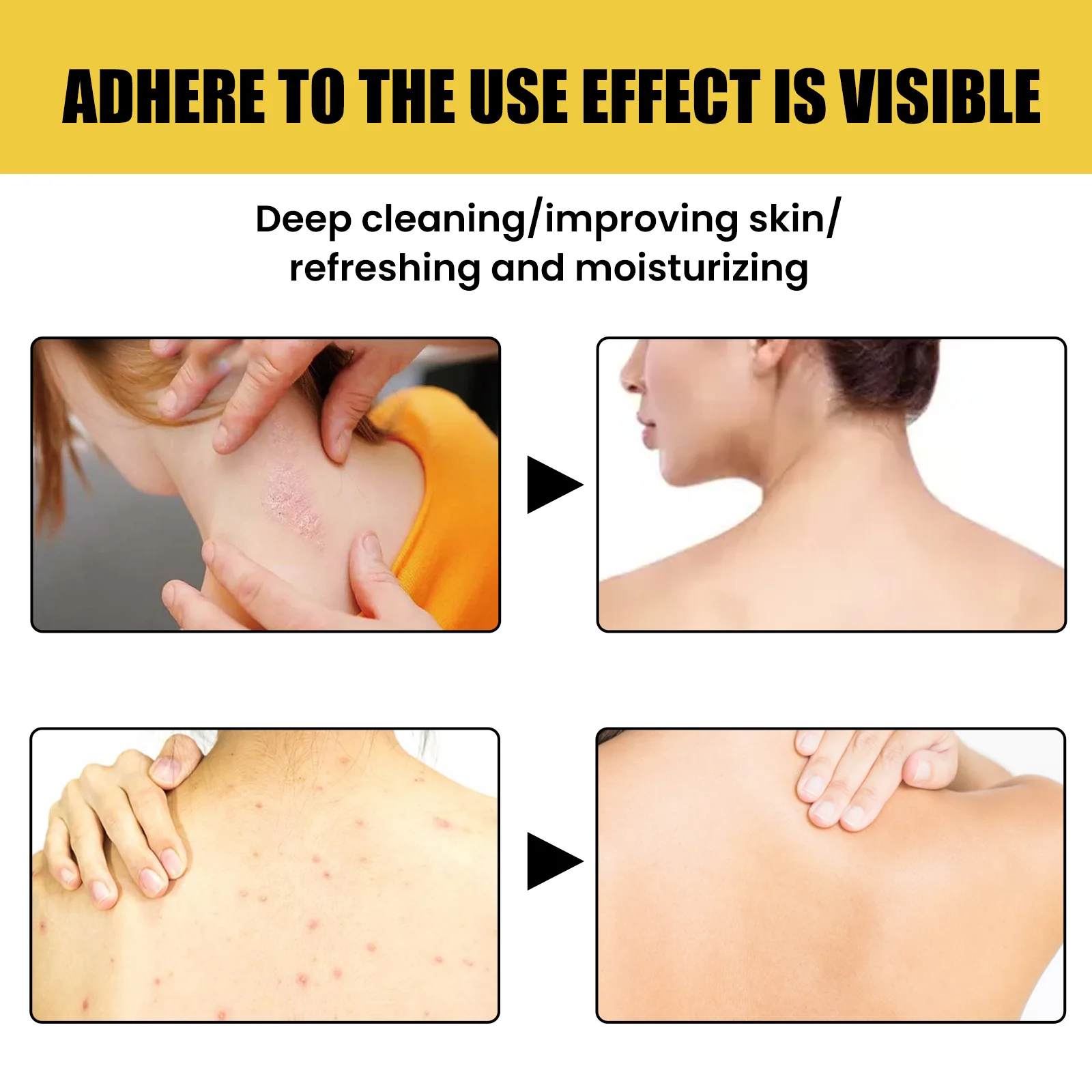 Рисунок 6 - Увлажняющее Отбеливающее мыло для лечения псориаза