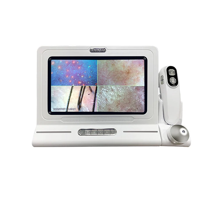 

Top Quality Smart Skin And Hair Analyser Detector Multi-Function Skin Analyzer Hair Follicle Scalp Detector With 11 inch Screen