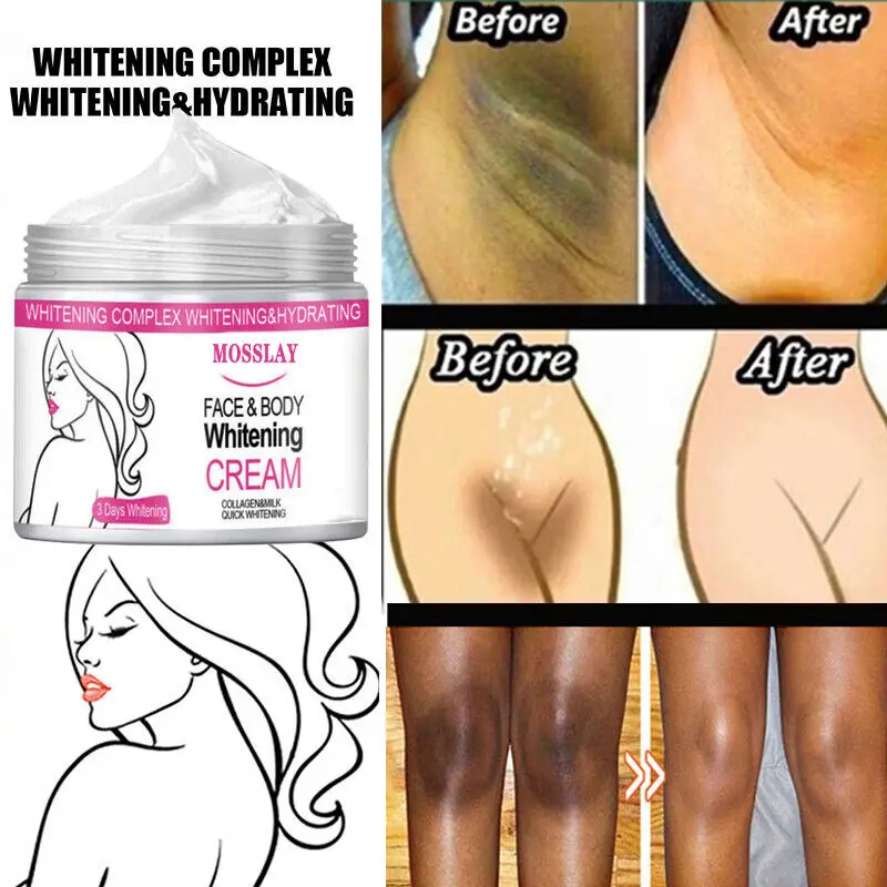 

Black Skin Permanent Bleaching Cream Collagen Whitening Blemish Brightening Women's Private Parts Anti-wrinkle Essence Cream
