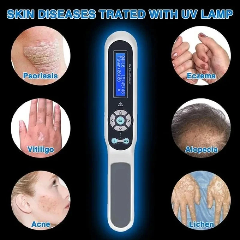 308nm Handheld uvb Light Therapy Portable Effective To Treat vitiligo Psoriasis Eczema Uvb Lamps Uv Phototherapy Instrinstrument 2