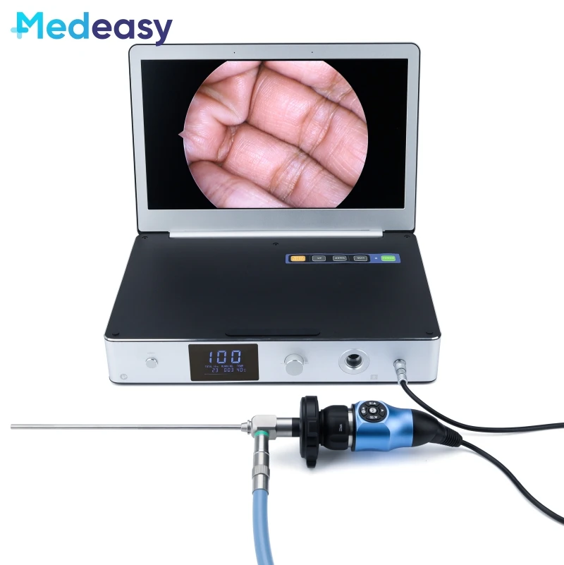 

Portable All In One Medical Endoscopy Camera System Full HD with 11.6 Inch Monitor and 30W LED Light Source
