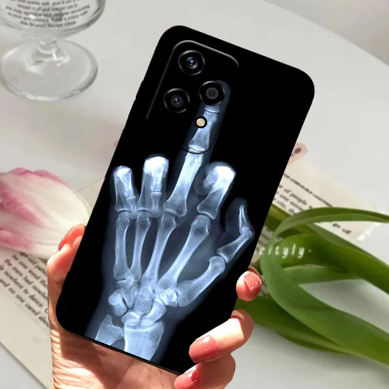 Shockproof Soft TPU Silicone Phone Case - Cartoon Matte Bumper Cover