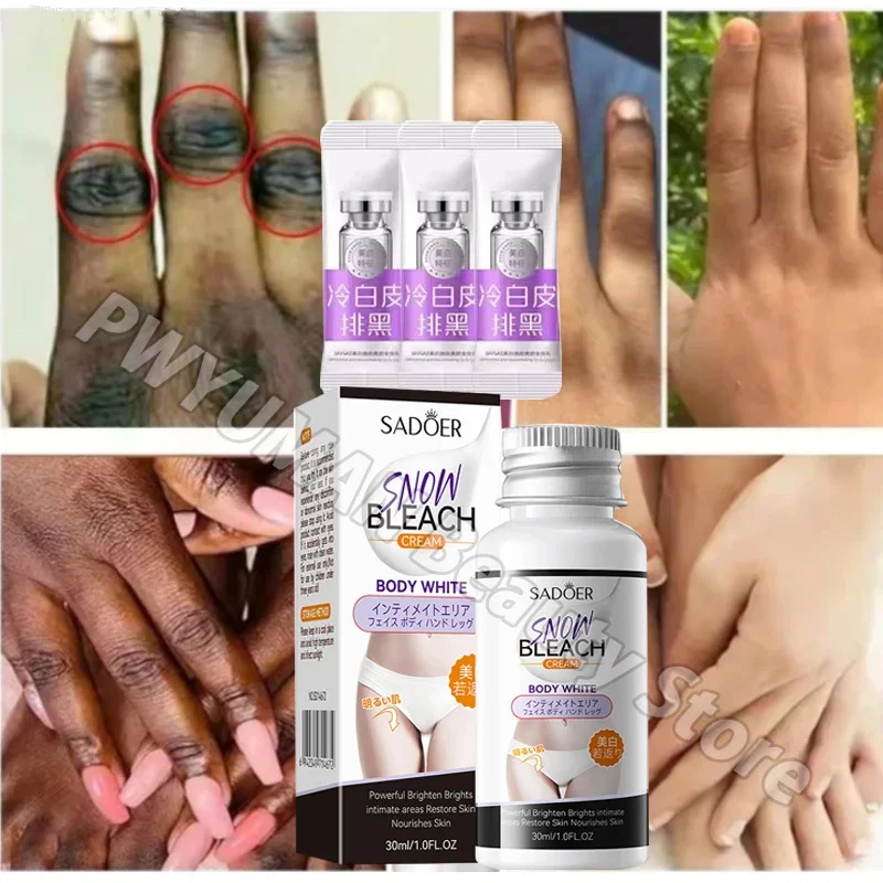 Whitening Cream Private Parts Underarm Inner Thigh Elbows Brighten Remove Melanin