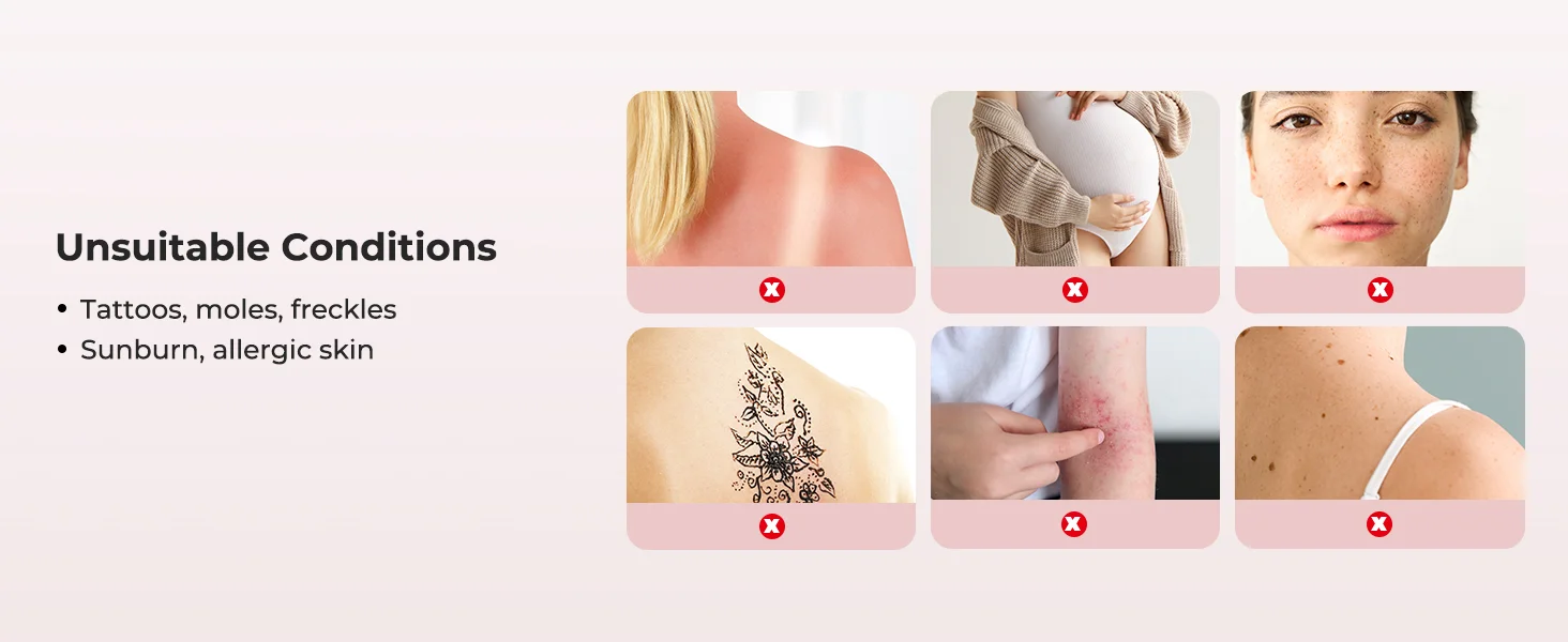 Ipl Laser Hair Removal Device For Face And Body With Ice Cooling_voghion.com