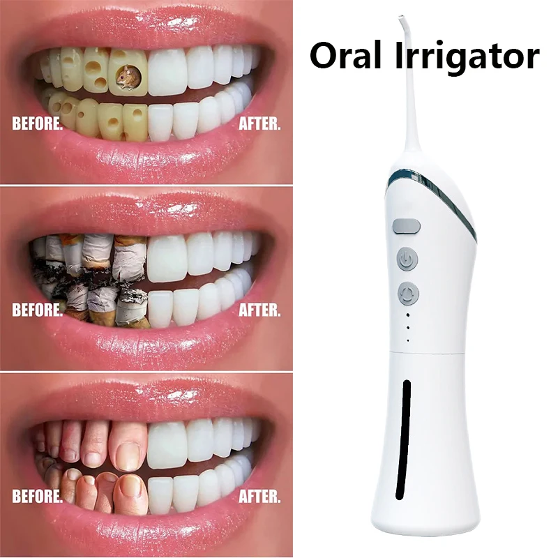 Dental Jet Water Jet Dental Water Flosser Orthodontic Braces Oral