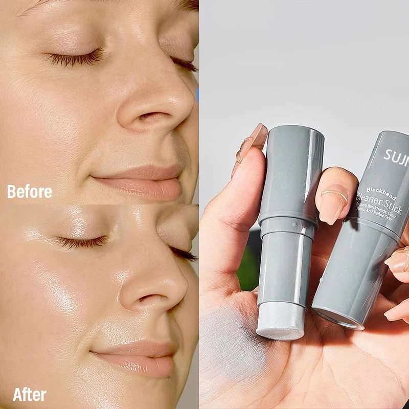 Description Picture 5 of itemOriginal Facial Remove Blackhead Stick Solid Mask Treat Acne Blemish Black Dots Deep Cleansing Cream Shrink Pores Skin Care 9g