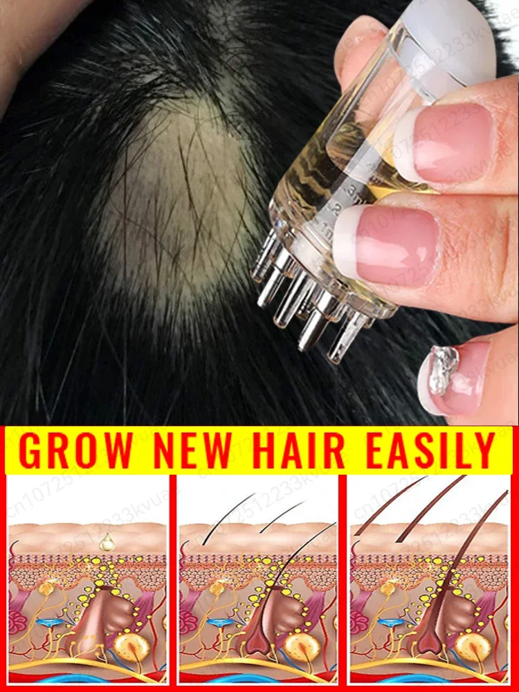 

Mini Portable Scalp Applicator Liquid Comb Hair Roots Massage Medicine Comb Hair For Hair Growth Serum Oil Nourish