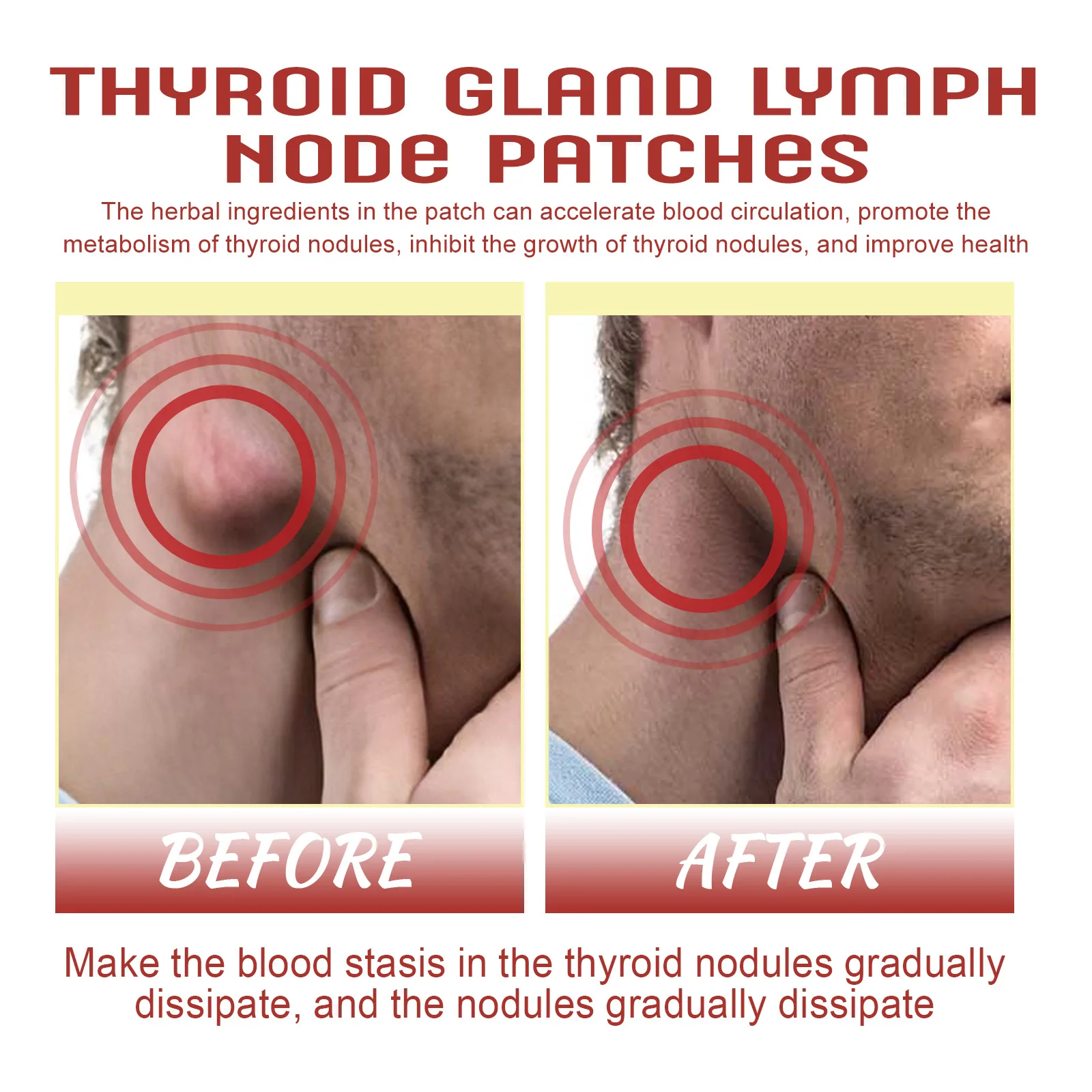 Lymphatic Detox Patch Drainage Thyroid Gland Stickers Effective Painless Treatment Heating Neck Anti Swelling Lymph Node Patches_voghion.com