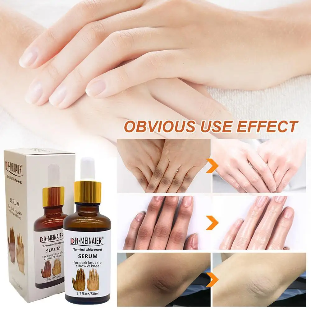 

50ml Hand Whitening Serum Removing Dark Knuckles Elbow Knee Melanin Whitening Hand Essence Skin Care Hand Knuckle Glow Serum