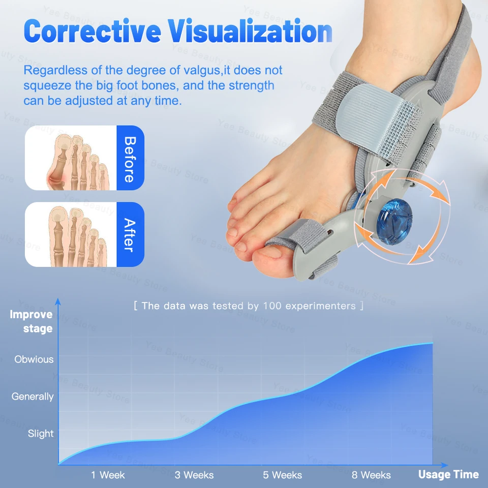 Separatore regolabile per alluce valgo, correttore per dita dei piedi, raddrizzatore per dita dei piedi, pedicure ortopedica_voghion.com