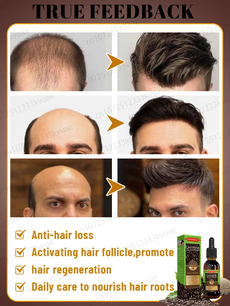 Essential oils that promote rapid hair growth and treat baldness and hair loss