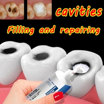 충치 제거 플라그 얼룩, 충치 제거, 부식 미백, 황변 치아 수리, 치아 미백 2023, 200ml, 신제품