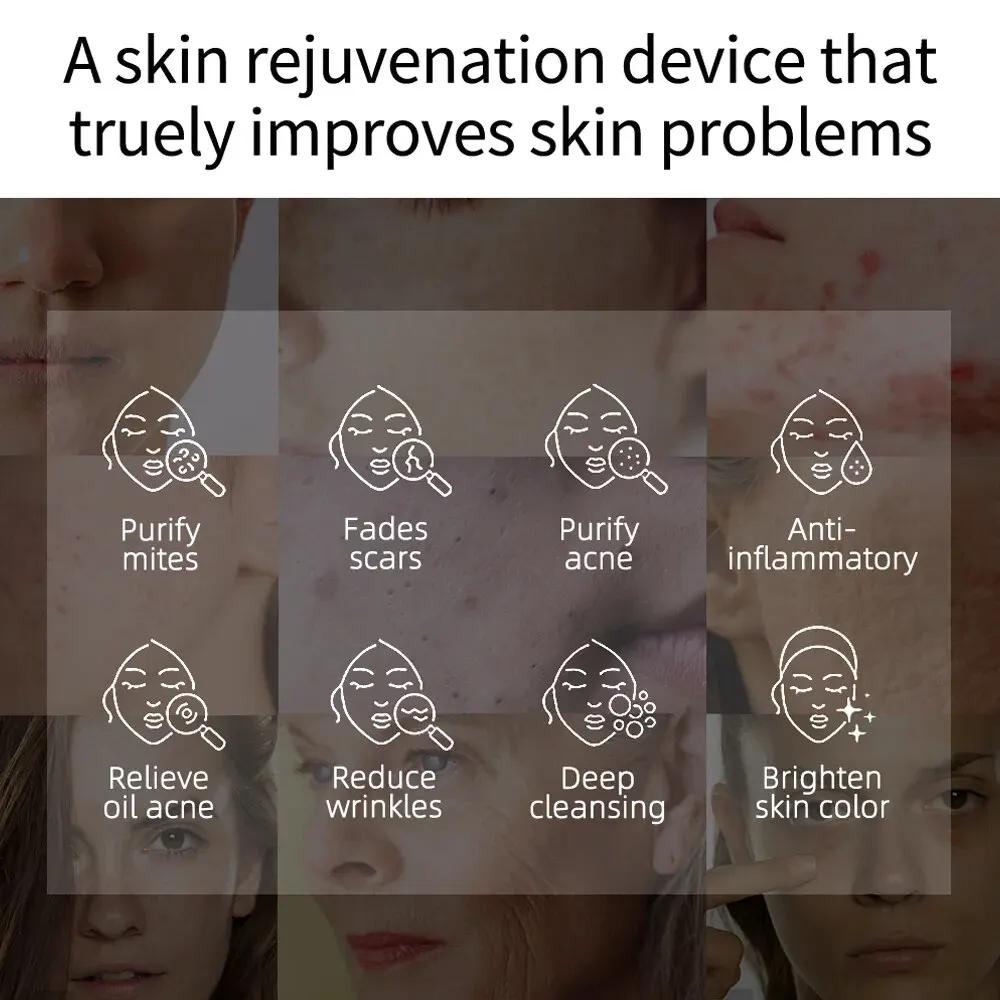 Kinseibeauty Plasma Beauty Instrument