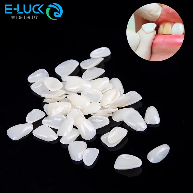 50pcs Dental Teeth Veneers Temporary Crown Ultra-Thin Resin For Dentistry Teeth Protecting Oral Care