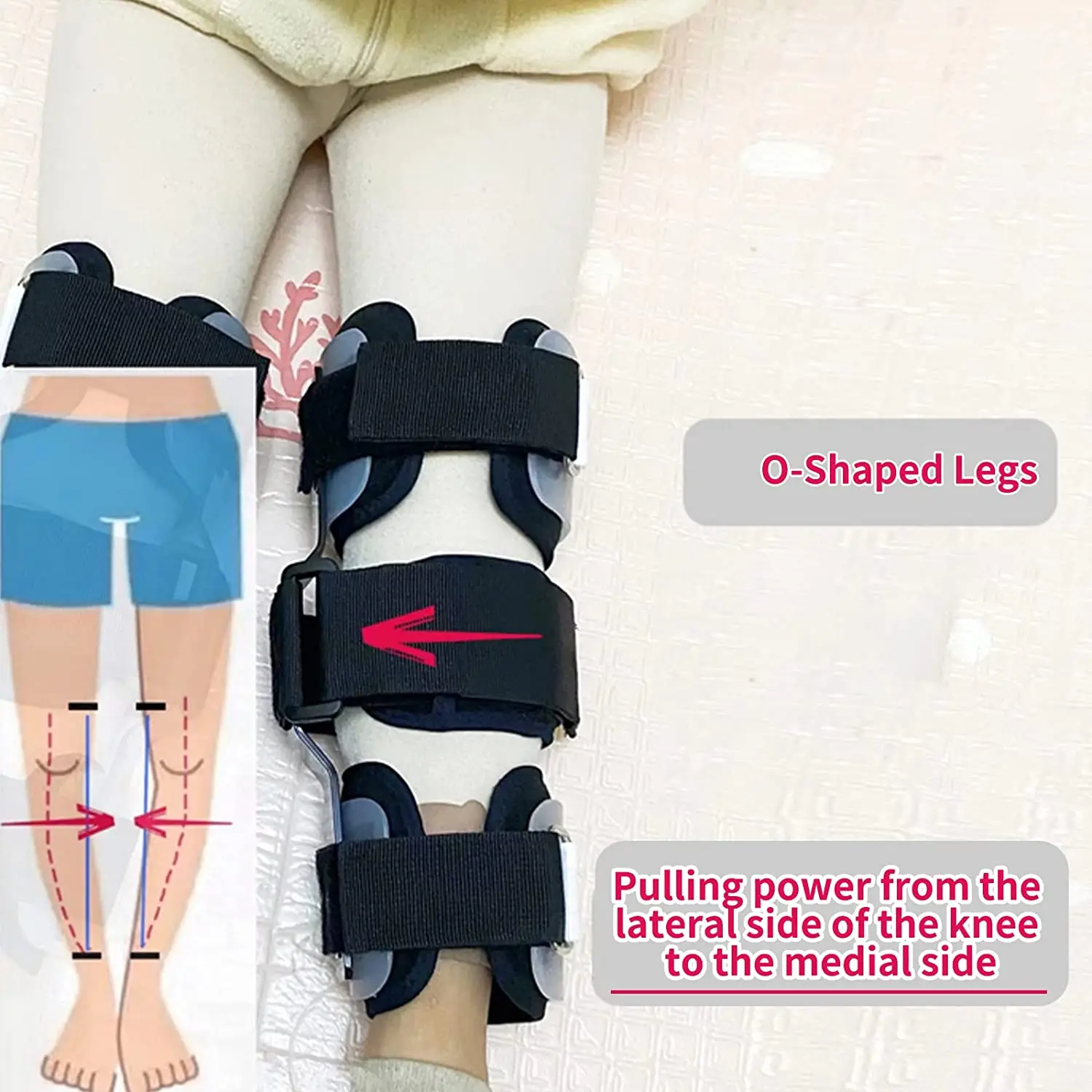 GHORTHOUD Kids O/X Leg Posture Corrector Brace Knees Valgus Straighten Bow-legged Correction Braces Adjustable 3