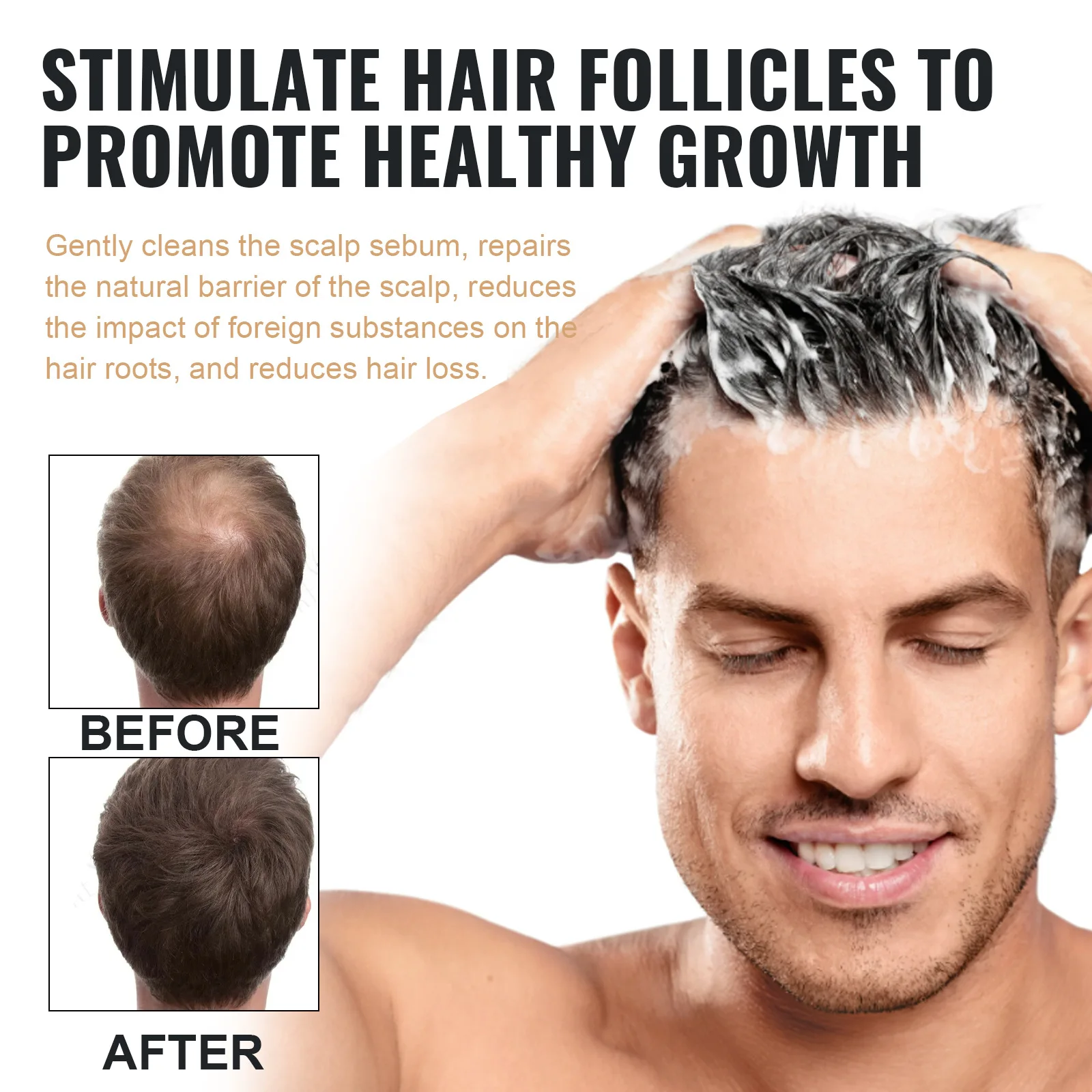 Hair Loss Treatment Shampoo Promote Growth Strengthen Hair Roots Scalp Repair Anti Thinning Moisturizing Thickening Hair Care 3