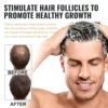 Hair Loss Treatment Shampoo Promote Growth Strengthen Hair Roots Scalp Repair Anti Thinning Moisturizing Thickening Hair Care 3