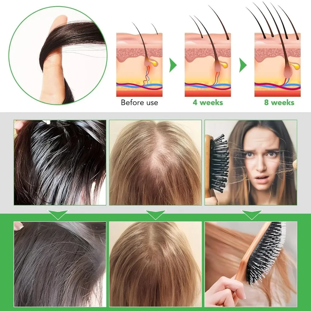 Platycypress Leaf Polygonum Herb Shampoo Nourishing Conditioner Improve White Hair for Thinning Hair Loss Growth for Men Women 2